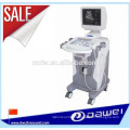 medical sonoscape ultrasound diagnostic equipment